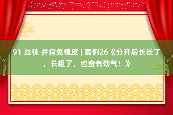 91 丝袜 并指免植皮 | 案例26《分开后长长了，长粗了，也蛮有劲气！》